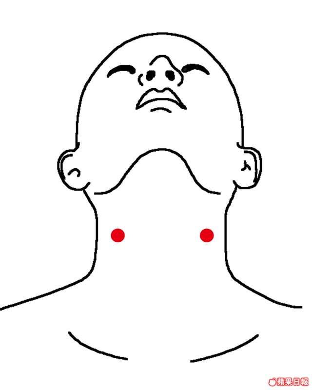 咽喉炎 (4).jpg