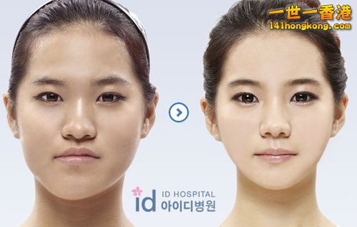 korean_plastic_surgery_06.jpg