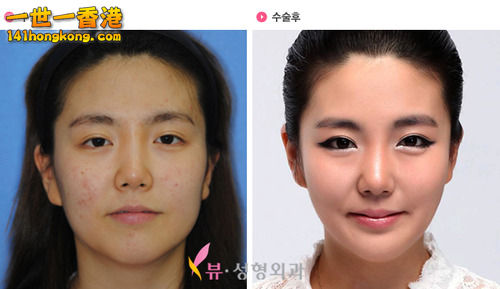 korean_plastic_surgery_07.jpg