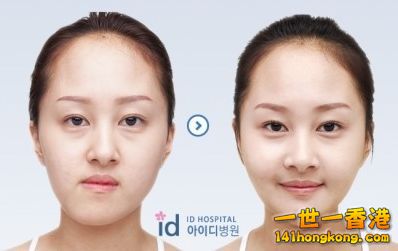 korean_plastic_surgery_08.jpg