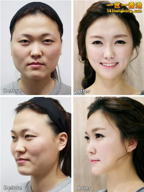 korean_plastic_surgery_09.jpg