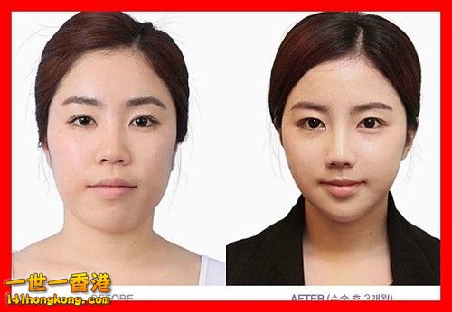 korean_plastic_surgery_10.jpg