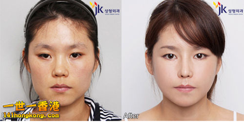 korean_plastic_surgery_15.jpg