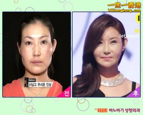 korean_plastic_surgery_16.jpg