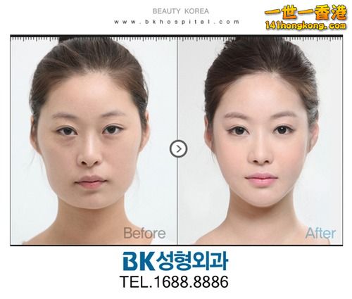 korean_plastic_surgery_18.jpg