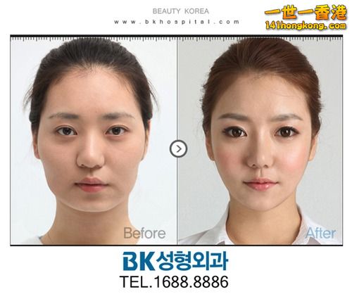 korean_plastic_surgery_19.jpg