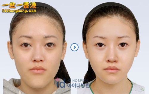 korean_plastic_surgery_21.jpg