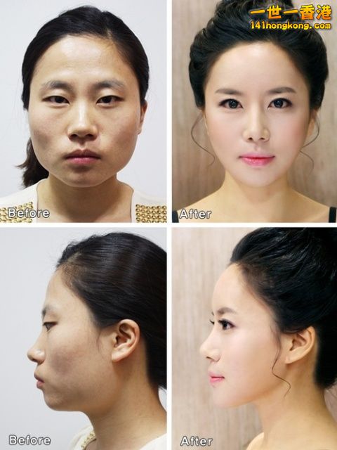 korean_plastic_surgery_22.jpg