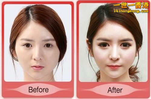 korean_plastic_surgery_27.jpg