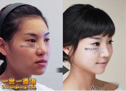 korean_plastic_surgery_28.jpg