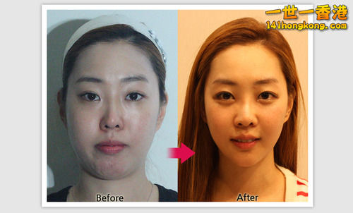 korean_plastic_surgery_30.jpg