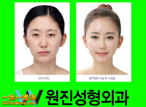 korean_plastic_surgery_35.jpg