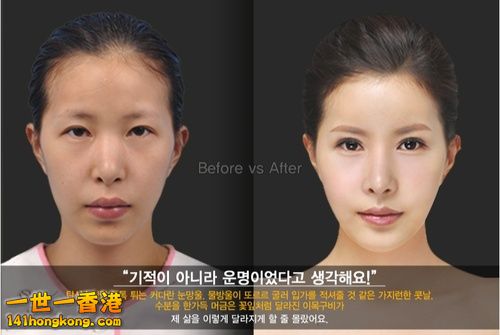 korean_plastic_surgery_37.jpg