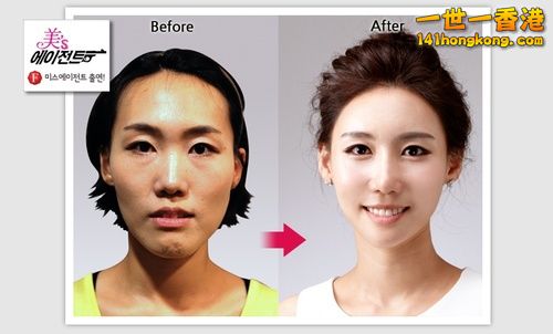 korean_plastic_surgery_38.jpg