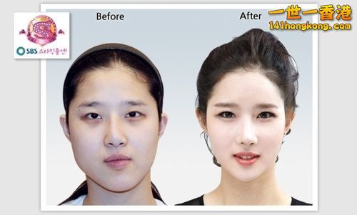 korean_plastic_surgery_40.jpg