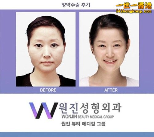 korean_plastic_surgery_41.jpg