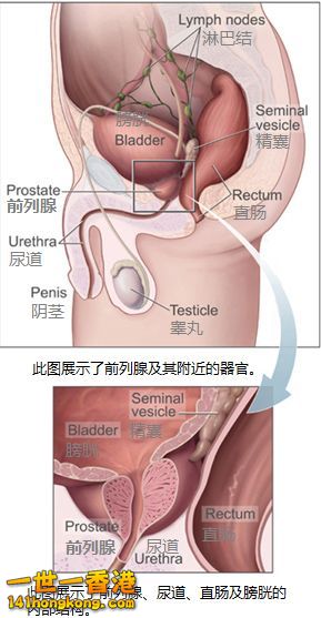 Prostatelead_zh.jpg