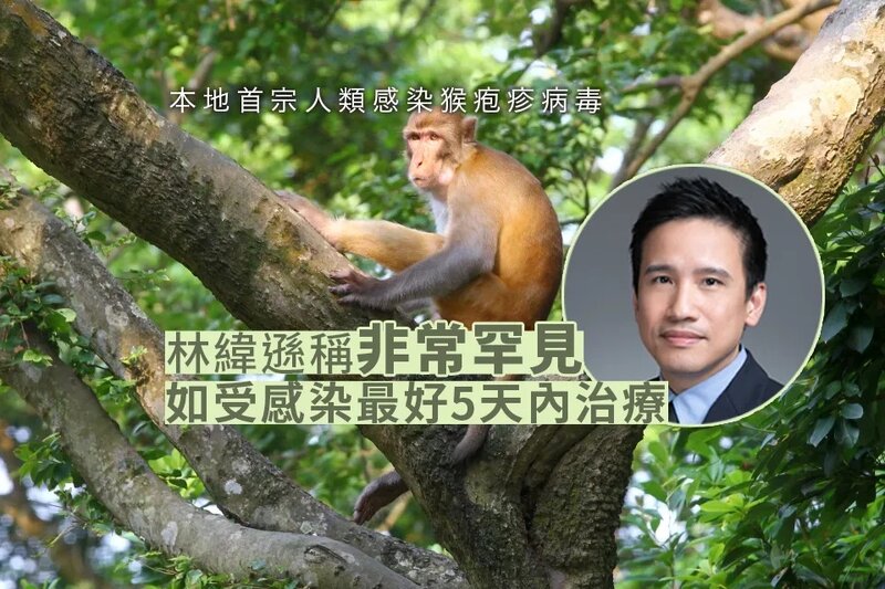 林緯遜稱人類感染猴疱疹病毒非常罕見 如受感染最好5天內治療.jpg