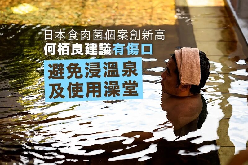 日本食肉菌個案創新高 何栢良建議有傷口避免浸溫泉及使用澡堂.jpg