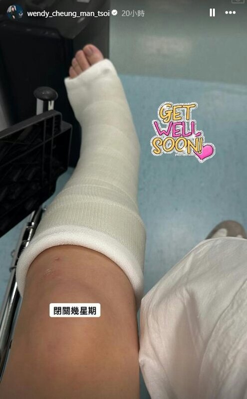 2 張文采跌腳了左腳，由腳趾至膝蓋前位置都打了石膏。.jpg